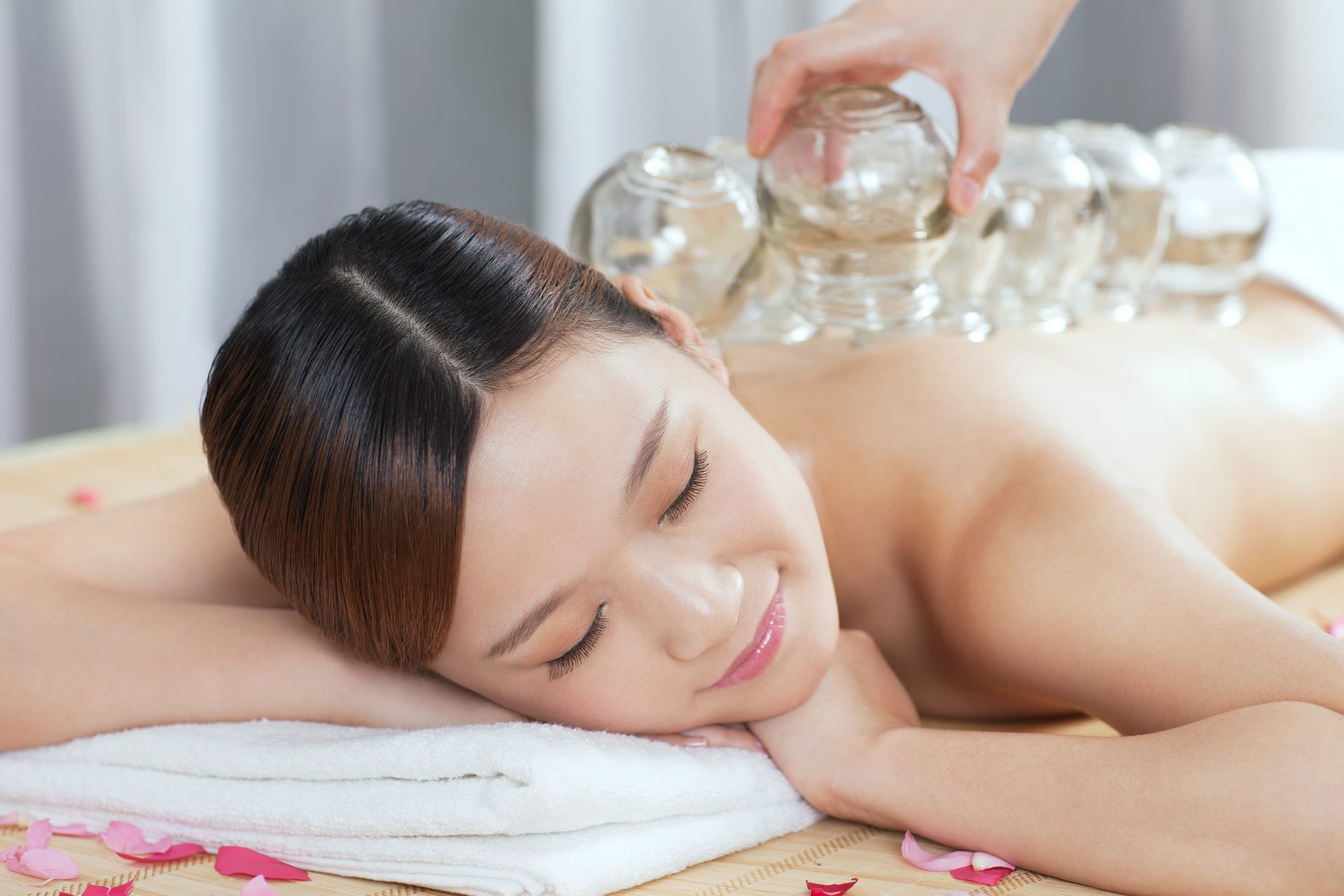 A Chinese medicine cupping of the young lady.